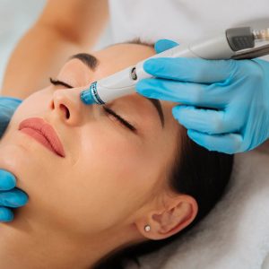 A woman in a clinic receiving a microneedling treatment to her face