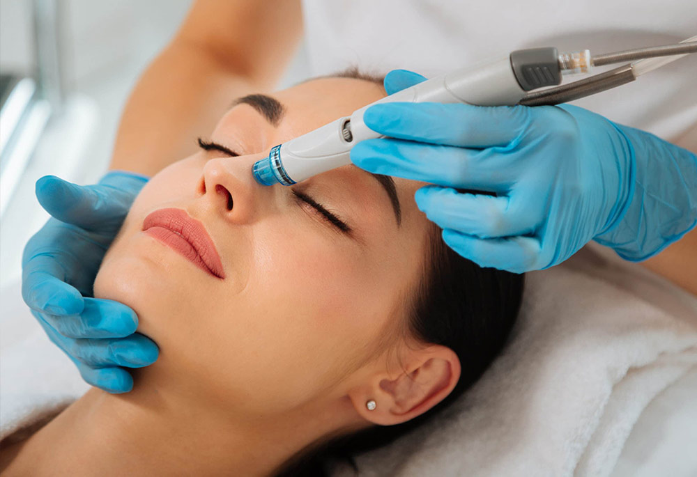 A woman in a clinic receiving a microneedling treatment to her face